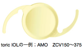toric IOLの一例；AMO　ZCV150〜375